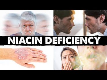 Strange & Weird Niacin (B3) Deficiency Signs and Symptoms