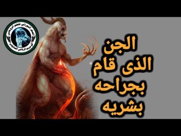 لكل طبيب بشرى انظر كيف قام الجن بعملية جراحية