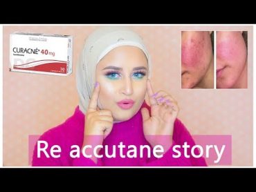 My story and tips for Reaccutane acne course  قصتي مع الريأكيوتان وحب الشباب وبعض النصايح المهمه