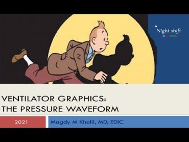 MV graphics: the pressure wave