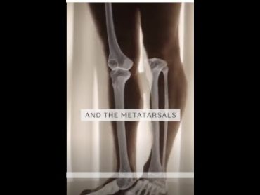 Anatomy for Dancers “improve your balance”  Dance Masterclass ballet class dancer anatomy