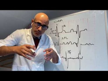 ٢اعلمك كيف تقرأ تخطيط القلب الكهربائي ECG الارتجاف الاذيني انته تشخصه  وليد سرحانالدورة السويدية