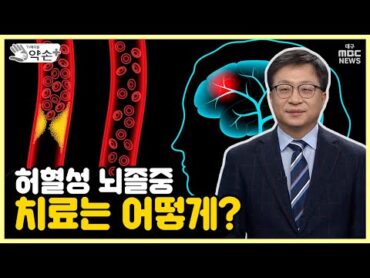 허혈성 뇌졸중 치료는? [늦으면 위험하다! 뇌혈관 질환 진단과 치료 ⑤]  메디컬 약손