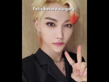 Felix before surgery 🤍 straykids shorts