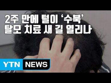 [자막뉴스] 2주 만에 털이 &39;수북&39;...탈모 치료 새 길 열리나 / YTN