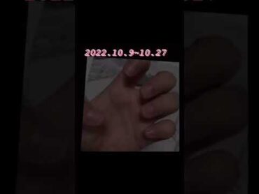 Nail growing 20일간 손톱 기르기