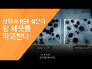 현미 속 RBF 성분이 암 세포를 파괴한다  (2010.2.18 322회 방송) 2010, 新항암식품사전  1편 현미와 콩