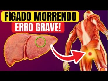 13 Sinais Estranhos de que você tem DANO HEPÁTICO! FÍGADO MORRENDO!