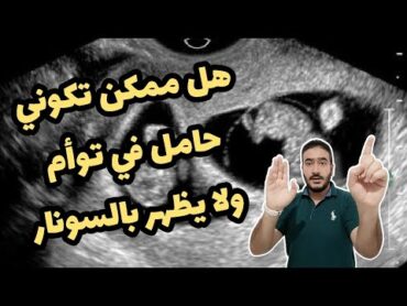 هل ممكن تكوني حامل في توأم ولا يظهر بالسونار؟ 👯هذه الاعراض تخبرك بأنك حامل بتوأم