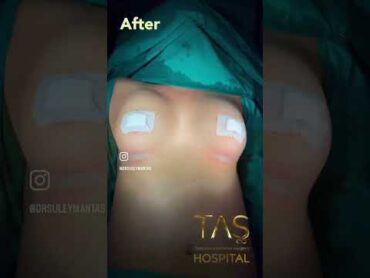 Breast aesthetics bestplasticsurgeon