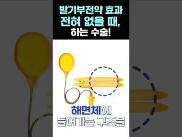 발기부전 ‘약’ 으로 해결 안되면? shorts 남성확대 발기부전 남성확대수술