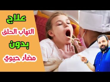 علاج التهاب الحلق بدون مضاد حيوي