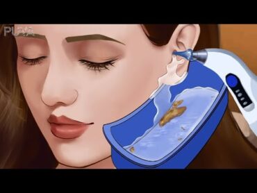 افضل روتين لتنظيف الأذن وأزالة الشمع   Ear Cleaning and Earwax Removal (ASMR)