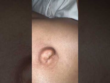 Hope yall enjoy the outie bellybutton. More videos to come