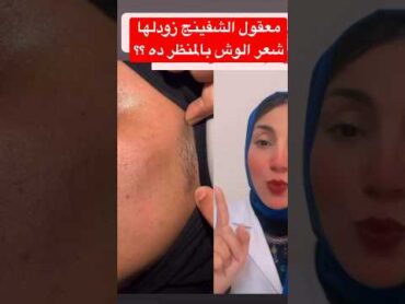 معقول الشفينج زودلها شعر الوش بالمنظر ده dr dina mahfouz تجميل شيفينج beauty البشرة