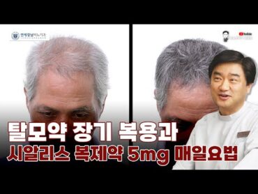 탈모약 장기 복용 환자 – 성기능 증진을 위한 시알리스 복제약 5mg 매일요법 좋은가요?