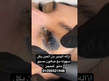 ازاله وشم العين مع صالون مسيو مانو للحجز 01205521948