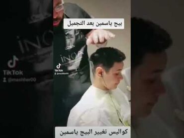 بعد التجميل بيج ياسمين اختلاف غير متوقع