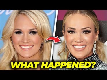 The Truth on What Happened to Carrie Underwood&39;s Face