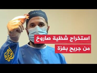 طبيب عراقي يوثق استخراج شظية صاروخ من جريح في غزة