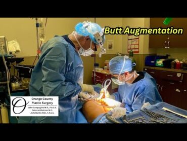 Butt Augmentation  Orange County Plastic Surgery plasticsurgeon plasticsurgeryresults