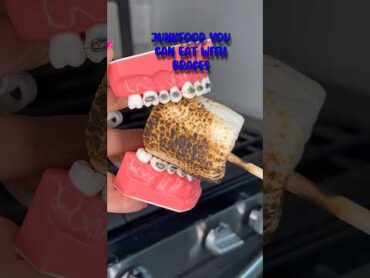 JUNKFOOD YOU CAN EAT WITHOUT BREAKING BRACES OFF 👀 ORTHODONTIST REACTS TO UNHEALTHY SNACKS 🦷